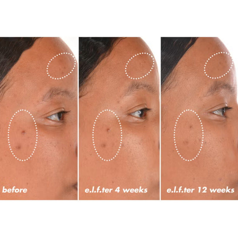 Elf Bright Icon Vitamin C + E + Ferulic Serum Mini 15ml Todo Tipo De Piel Día/noche