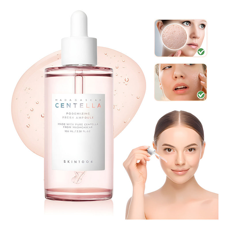 Ampoule Skin1004 Centella Madagascar Poremizing Fresh 100 Ml Todo Tipo De Piel Día/noche